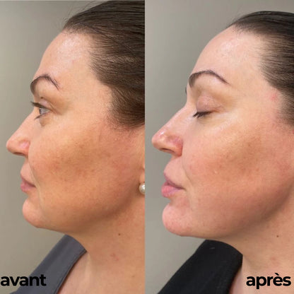 ROUTINE GLOWY SKIN By Carotina®