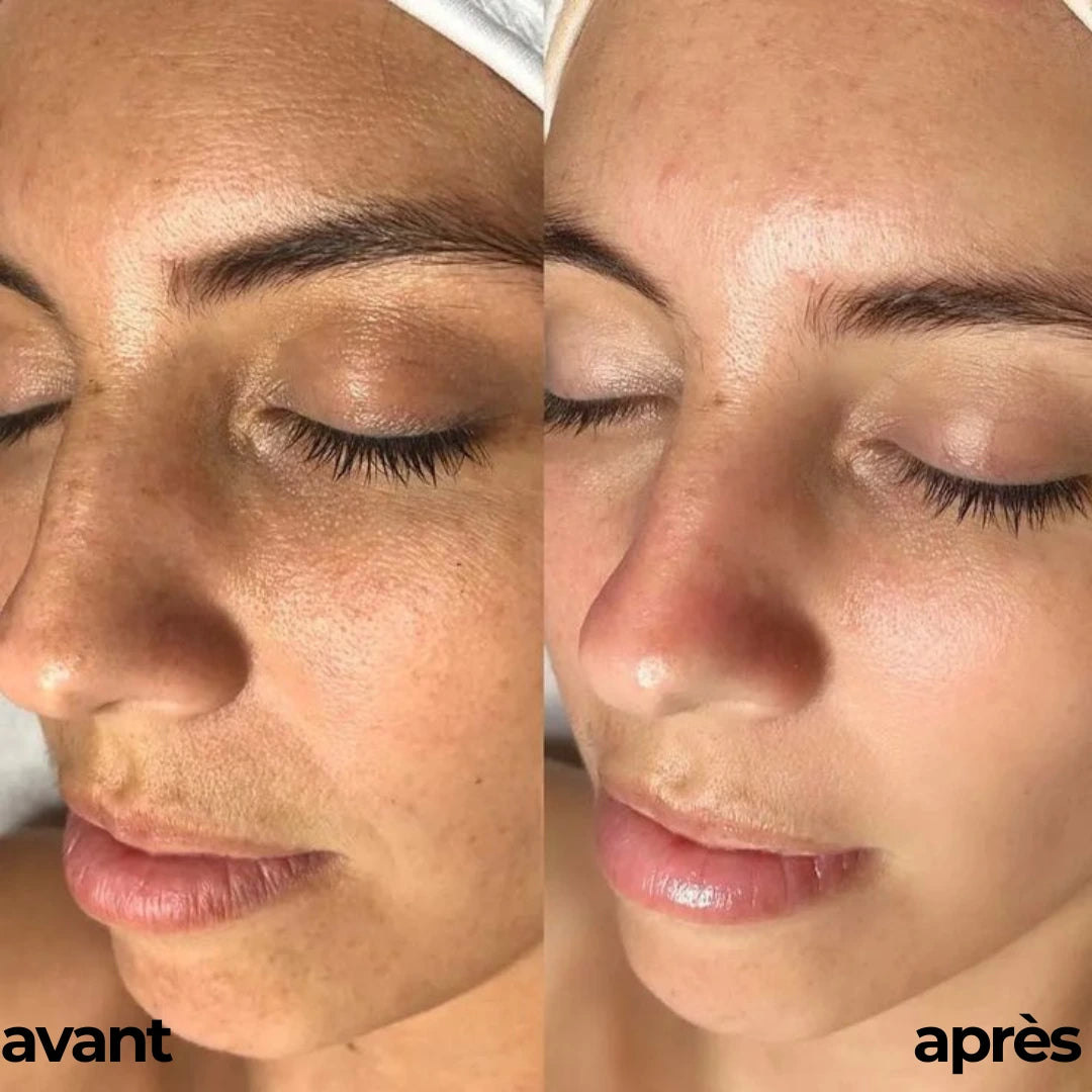 ROUTINE GLOWY SKIN By Carotina®