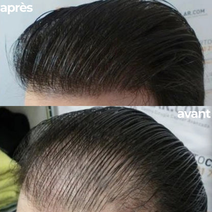 HAIR, SKIN & NAILS | 60 CAPS - Complément Alimentaire