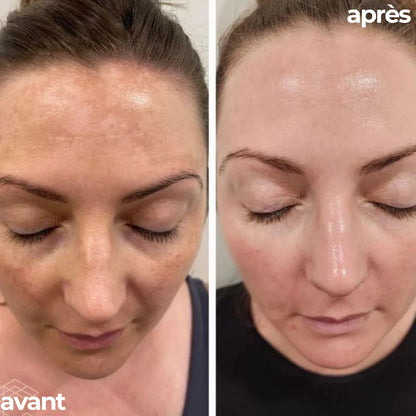 HAIR, SKIN & NAILS | 60 CAPS - Complément Alimentaire