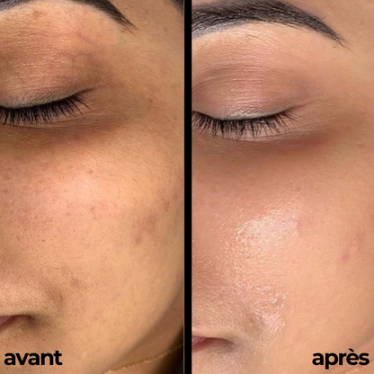CRÈME HYDRATANTE, ÈCLAIRCISSANTE & ANTI SOLEIL By Carotina®