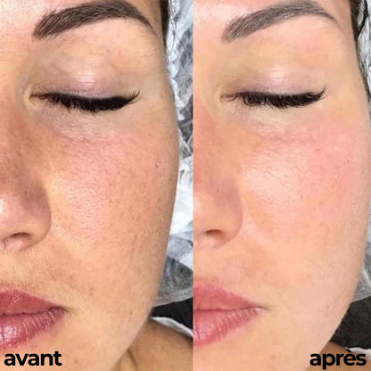 ROUTINE GLOWY SKIN By Carotina®