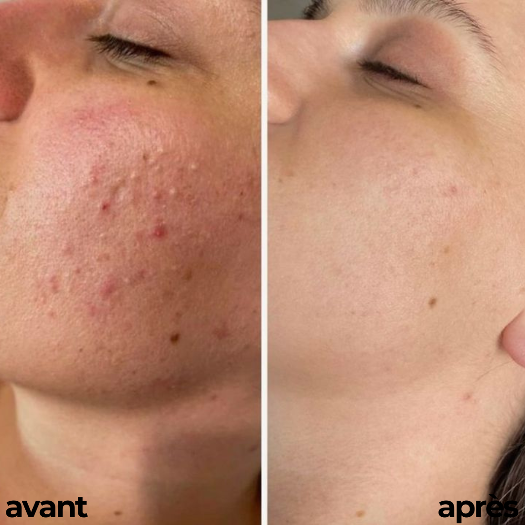 CRÈME HYDRATANTE, ÈCLAIRCISSANTE & ANTI SOLEIL By Carotina®