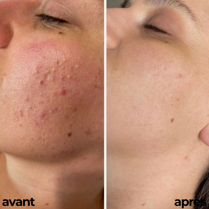 CRÈME HYDRATANTE, ÈCLAIRCISSANTE & ANTI SOLEIL By Carotina®