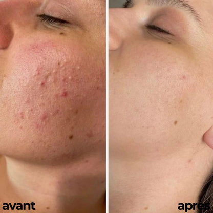 ROUTINE GLOWY SKIN By Carotina®