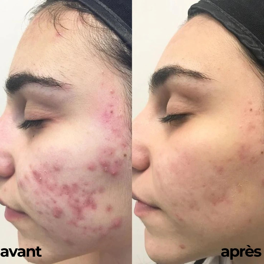 ROUTINE GLOWY SKIN By Carotina®