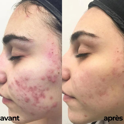ROUTINE GLOWY SKIN By Carotina®