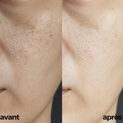 ROUTINE GLOWY SKIN By Carotina®